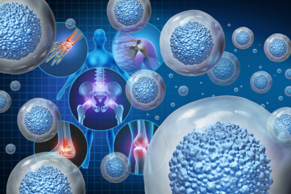 Regenerative Medicine treatment